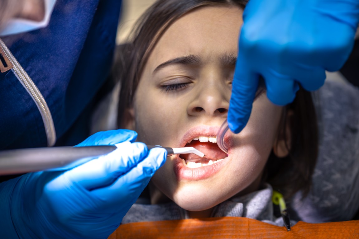 Smile Makeover