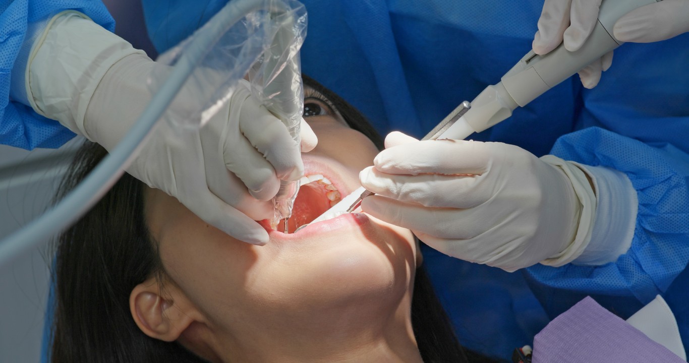 Smile Makeover