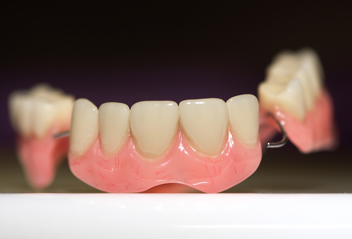 Smile Makeover