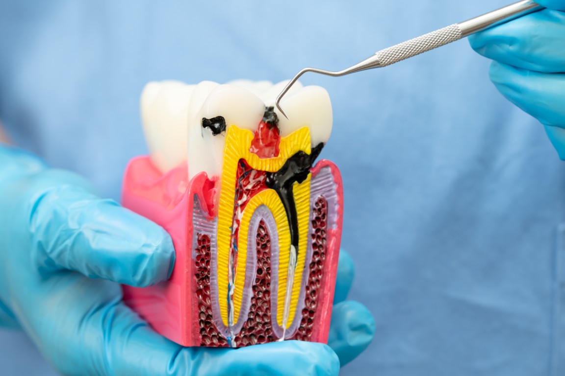 Smile Makeover