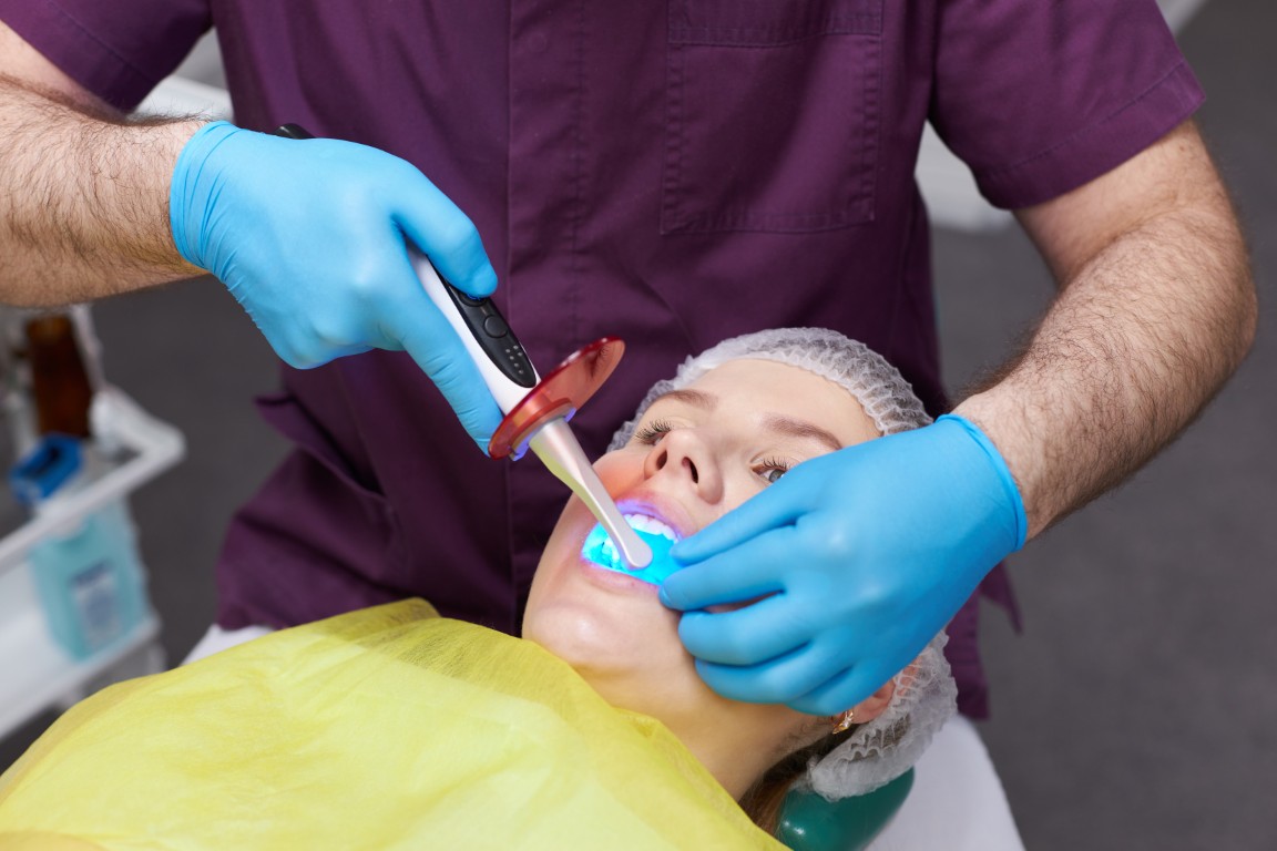 Smile Makeover